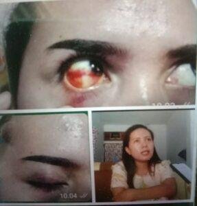 Pengeroyokan Oknum Istri Kades Sukosari, Jatiroto…
